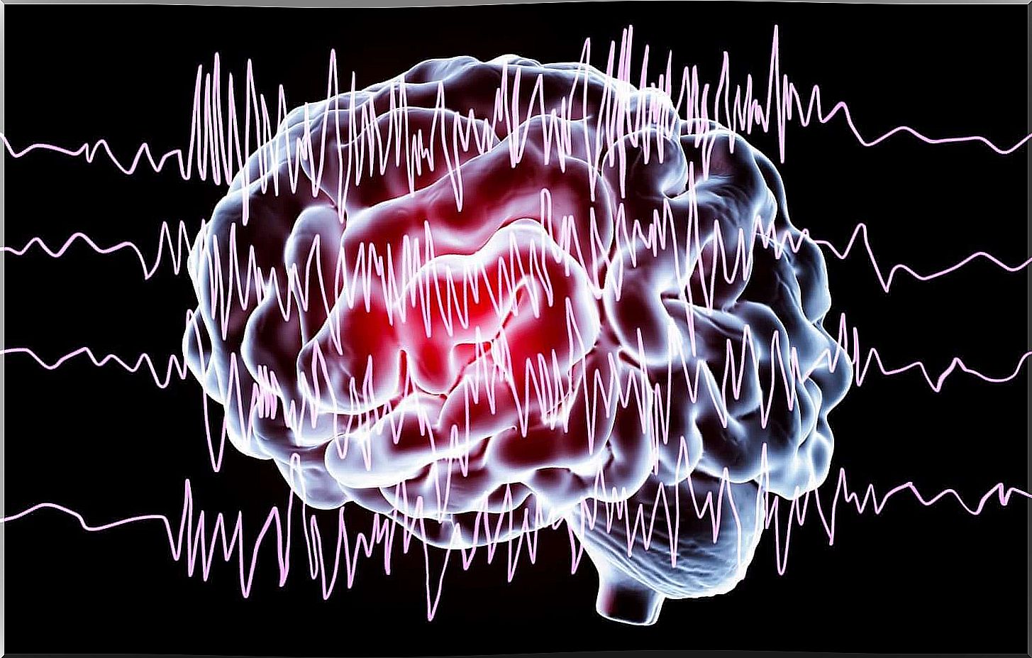 brain waves from the cerebral cloister